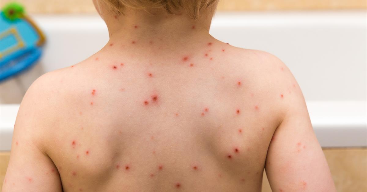 AboutKidsHealth