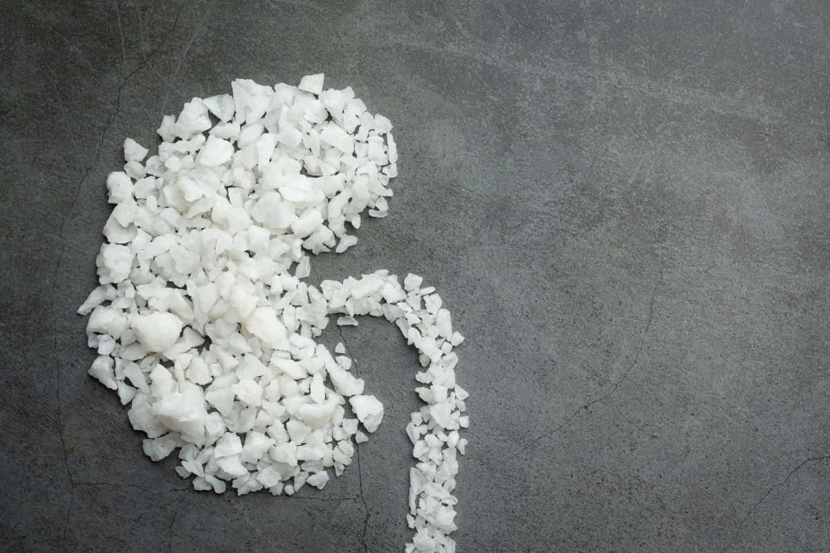 salt-shape-kidney-dark-floor